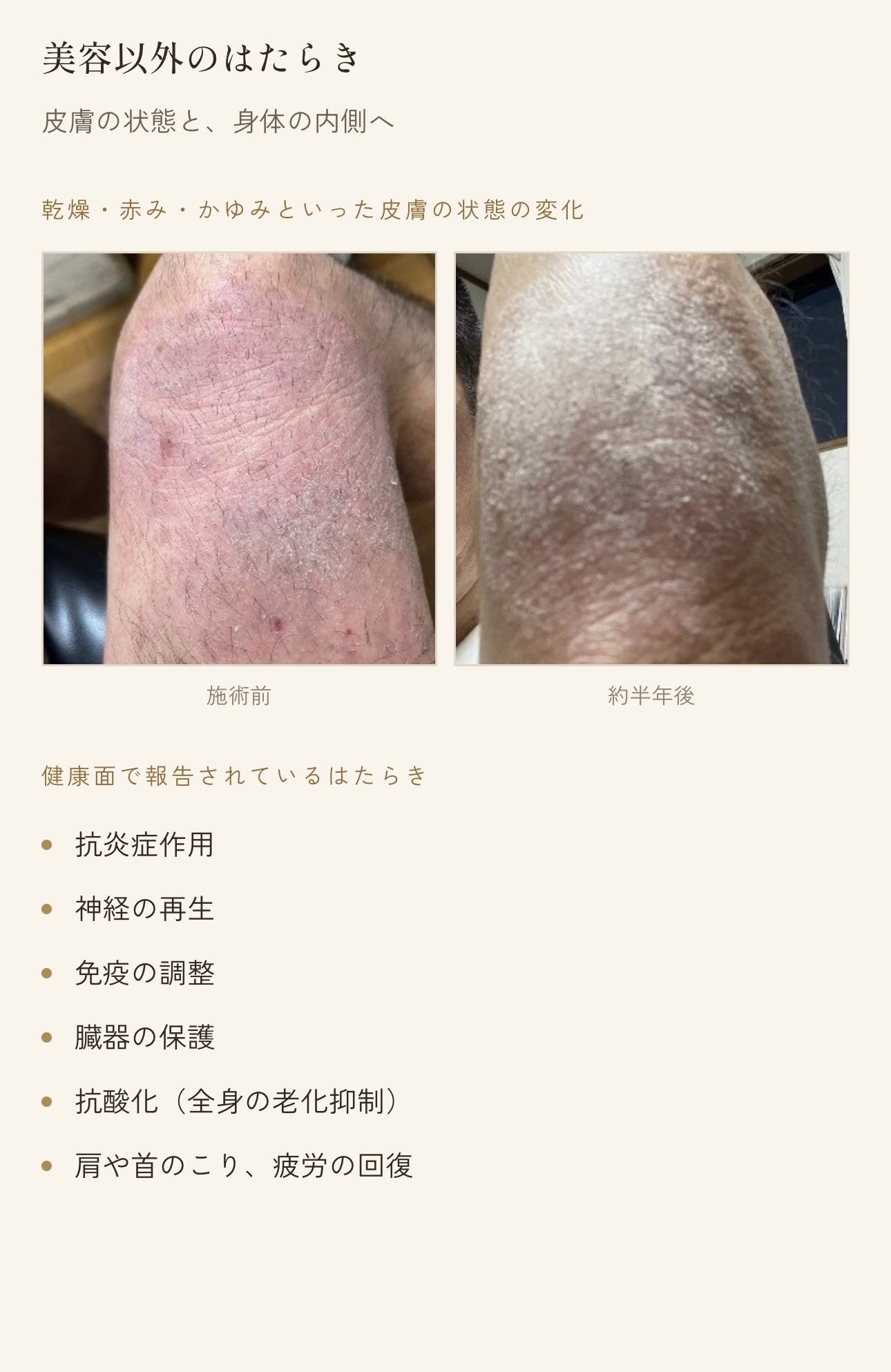 美容以外のはたらきとして皮膚状態の変化を記録した写真